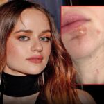 joey king oil injury main getty instagram composite