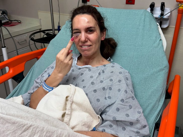 Christy Carlson Romano shot in face