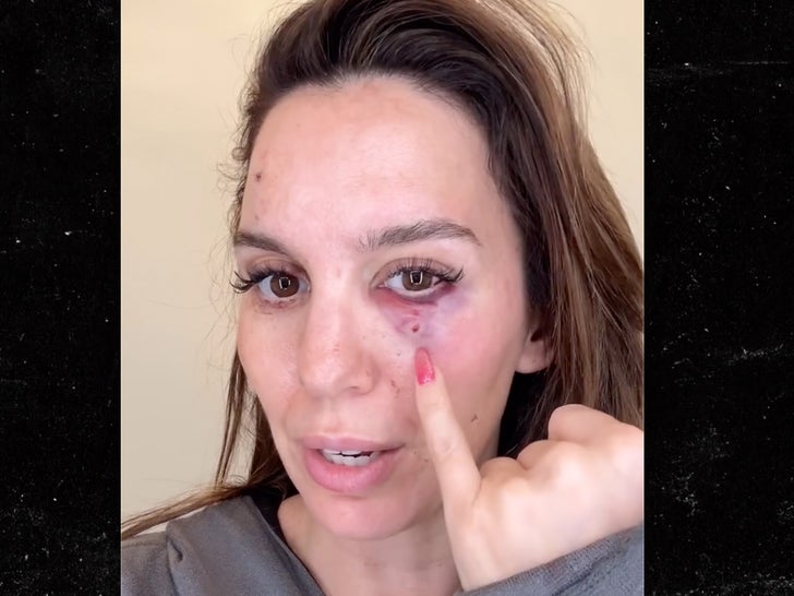 Christy Carlson Romano shot in face