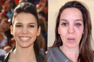 disney-channel-star-was-shot-in-the-eye-while-clay-shooting-christy-carlson-romano-reveals-terrifying-ordeal