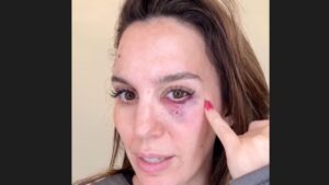 Christy Carlson Romano Shot in Face at Clay Pigeons Range