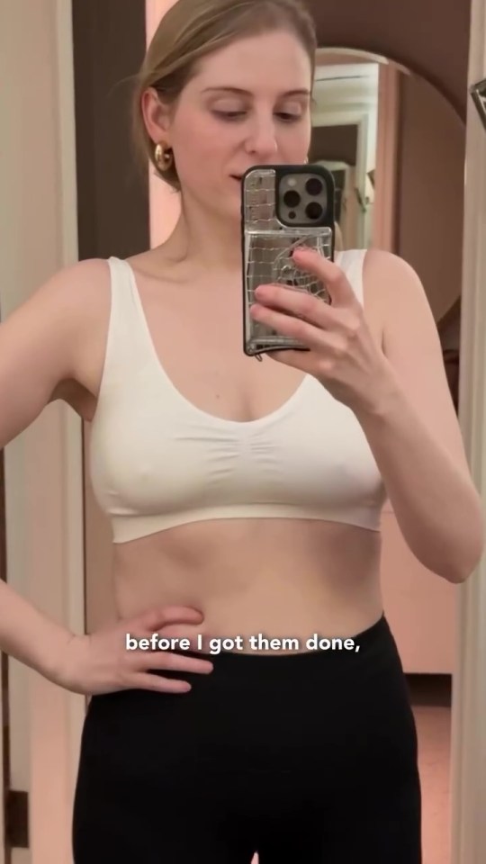 Meghan Trainor before breast augmentation, shown in a mirror selfie.