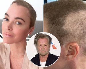 Teddi Mellencamp Details 'Day to Day' Decision to Wear Wig or Not