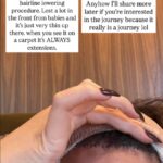 chrissy-teigen-startles-fans-with-graphic-photo-of-bandaged-face