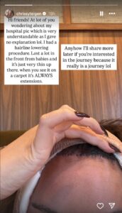 chrissy-teigen-startles-fans-with-graphic-photo-of-bandaged-face