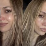 jennifer-lopez-gets-stitches-after-amas-rehearsal-accident