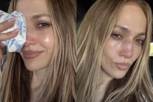 jennifer-lopez-gets-stitches-after-amas-rehearsal-accident