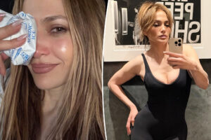 Jennifer Lopez cuts her face rehearsing for 2025 AMAs
