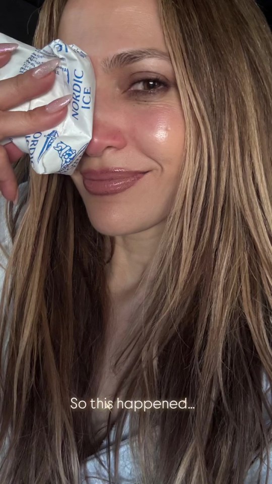 Jennifer Lopez with an ice pack on her eye.