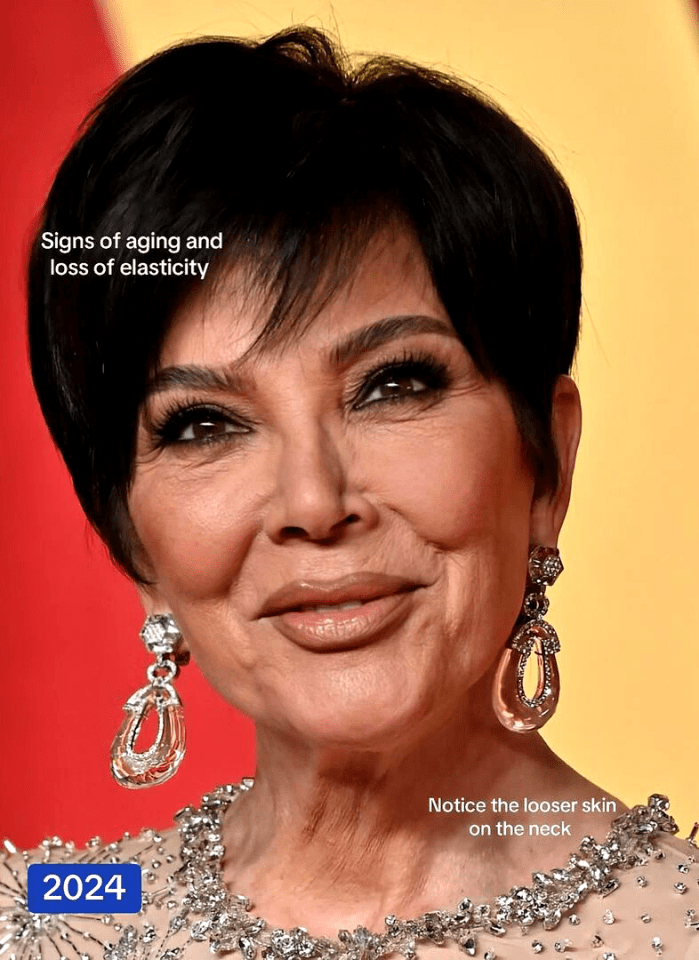Close-up of Kris Jenner showing signs of aging.