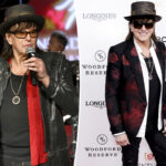 Richie Sambora fractures hand, forced to undergo surgery