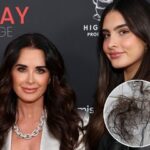 Sophia Umansky Reacts to Backlash Over Mounjaro Use After Revealing Hair Loss