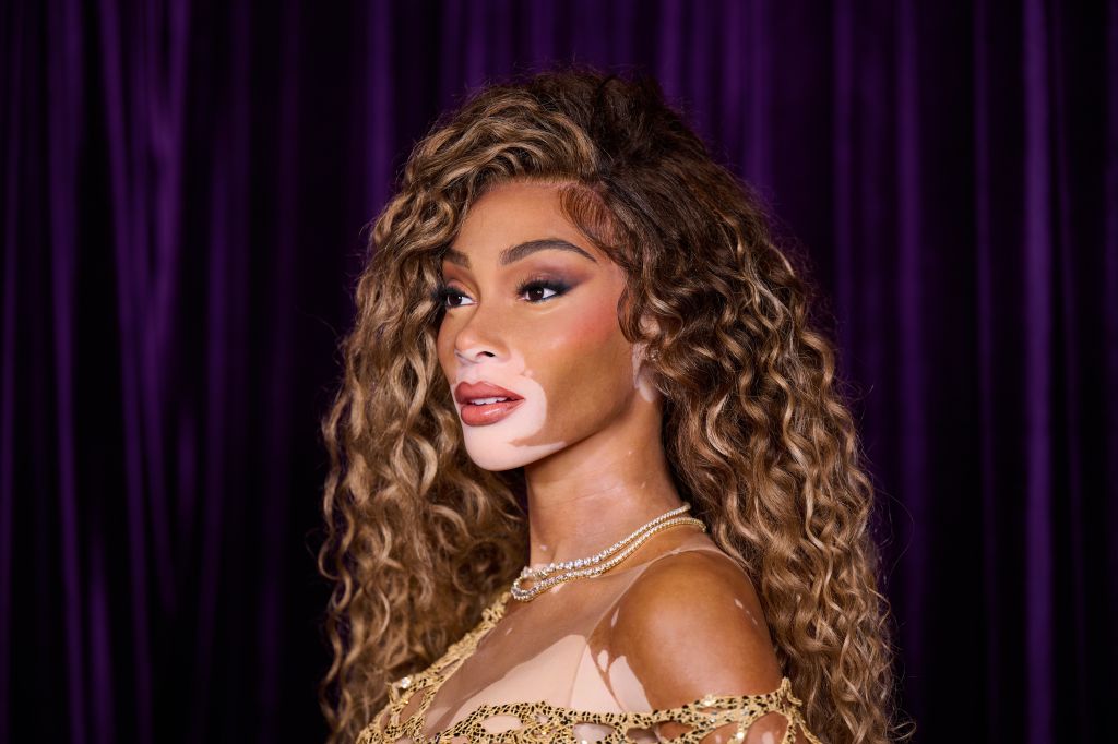 Winnie Harlow x Madame Tussauds