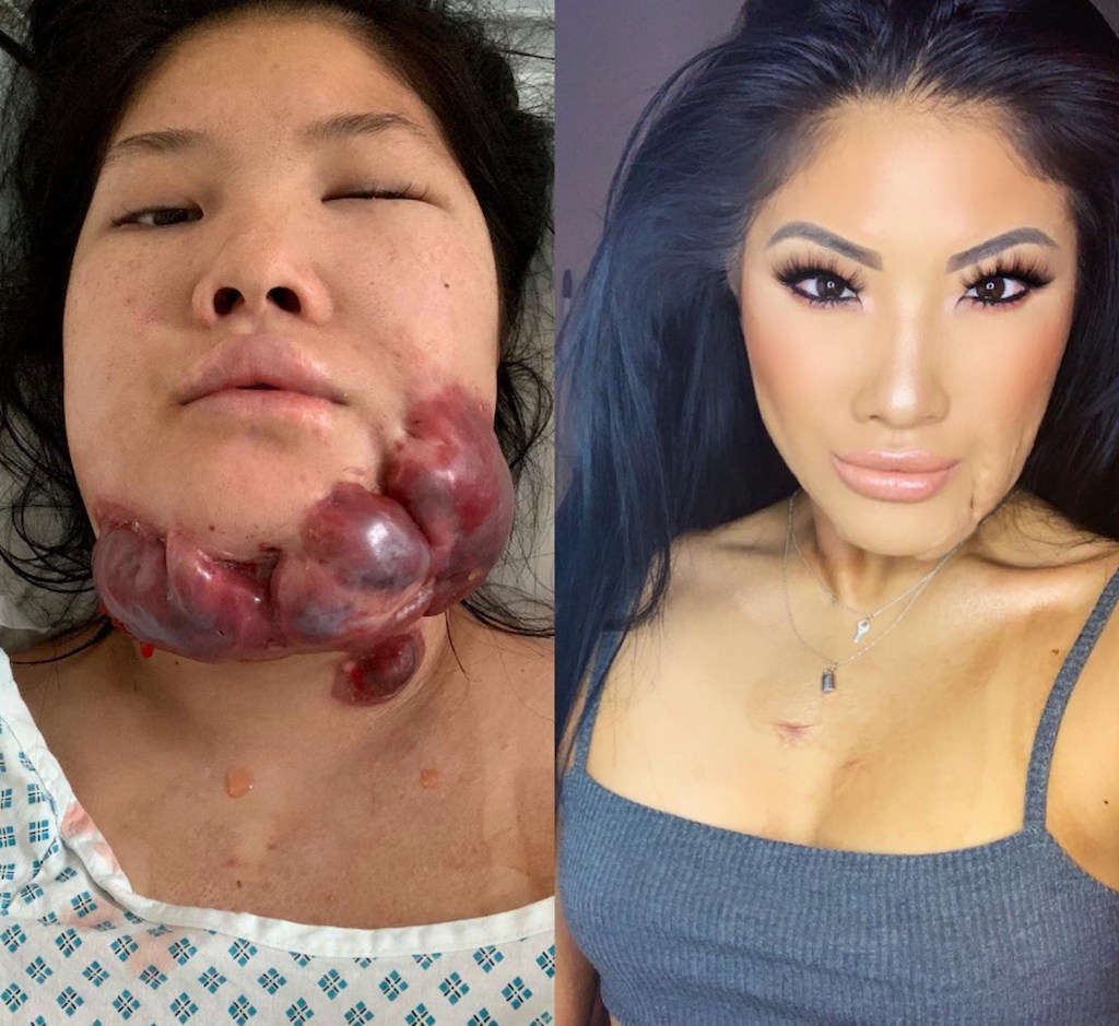How This 'Love Island' Contestant Nearly Died In A Fire Accident And Battled An “Incurable Tumor”