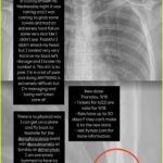 kacey xray