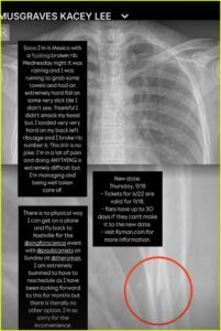 kacey xray