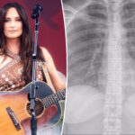Kacey Musgraves postpones show after breaking a rib