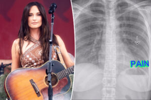 Kacey Musgraves postpones show after breaking a rib