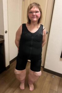 Tammy Slaton in shapewear after weight loss surgery.