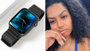 Is This Normal? Woman's Apple Watch Leaves Behind Marks