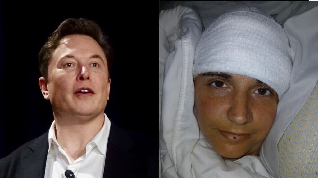 Paralysed woman writes name for first time in 20 years using Elon Musk’s Neuralink chip