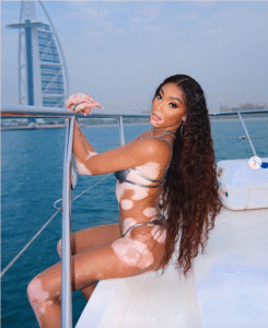 Winnie Harlow In Bikini "Brought Water" To Ibiza — Celebwell